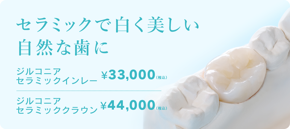 セラミックで白く美しい自然な歯に